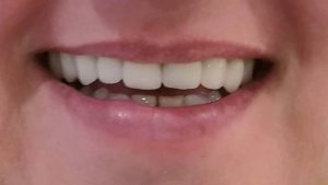 IMG_20180402_105700 (1)