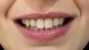 IMG_20180412_19040511