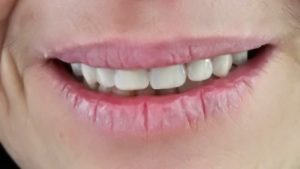 IMG_20190402_103825 (1)