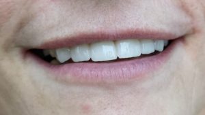 IMG_20191205_205607 (1)