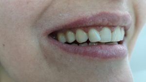 IMG_20200320_182225 (1)