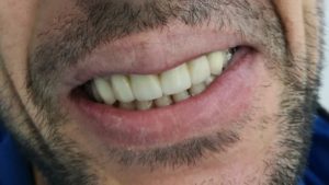 IMG_20200529_202749 (1)