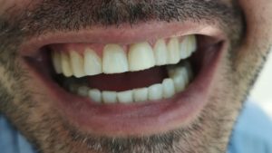 IMG_20200806_174145 (1)