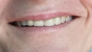 IMG_20210603_133750 (1)